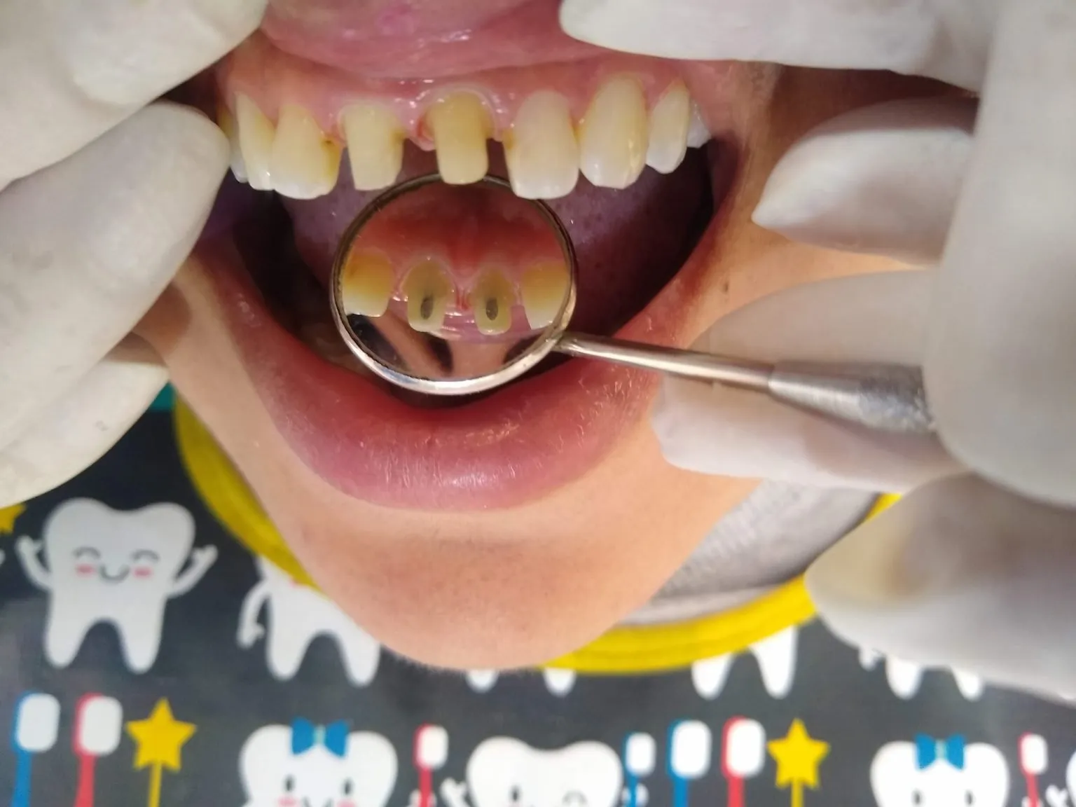 Rehabilitación Oral